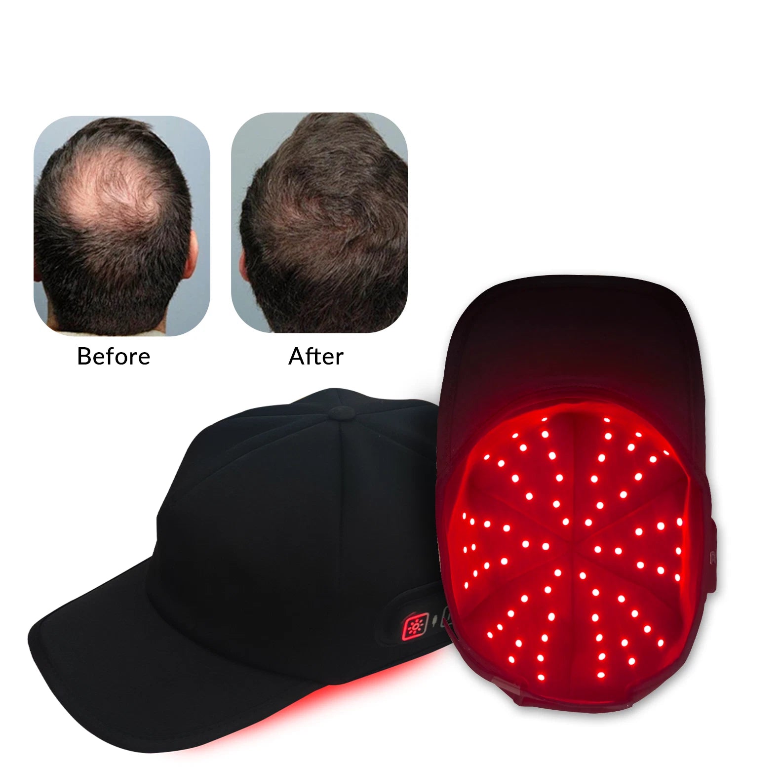 Hair Growth Red Light Therapy Cap - LED Scalp Treatment for Thinning Hair